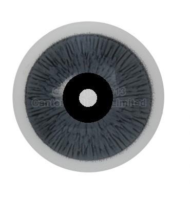 Lente protésica tipo pinhole con pupila central transparente utilizada para fotofobia, anisocoria o diplopía; diseño terapéutico que reduce la entrada de luz y mejora la simetría estética.