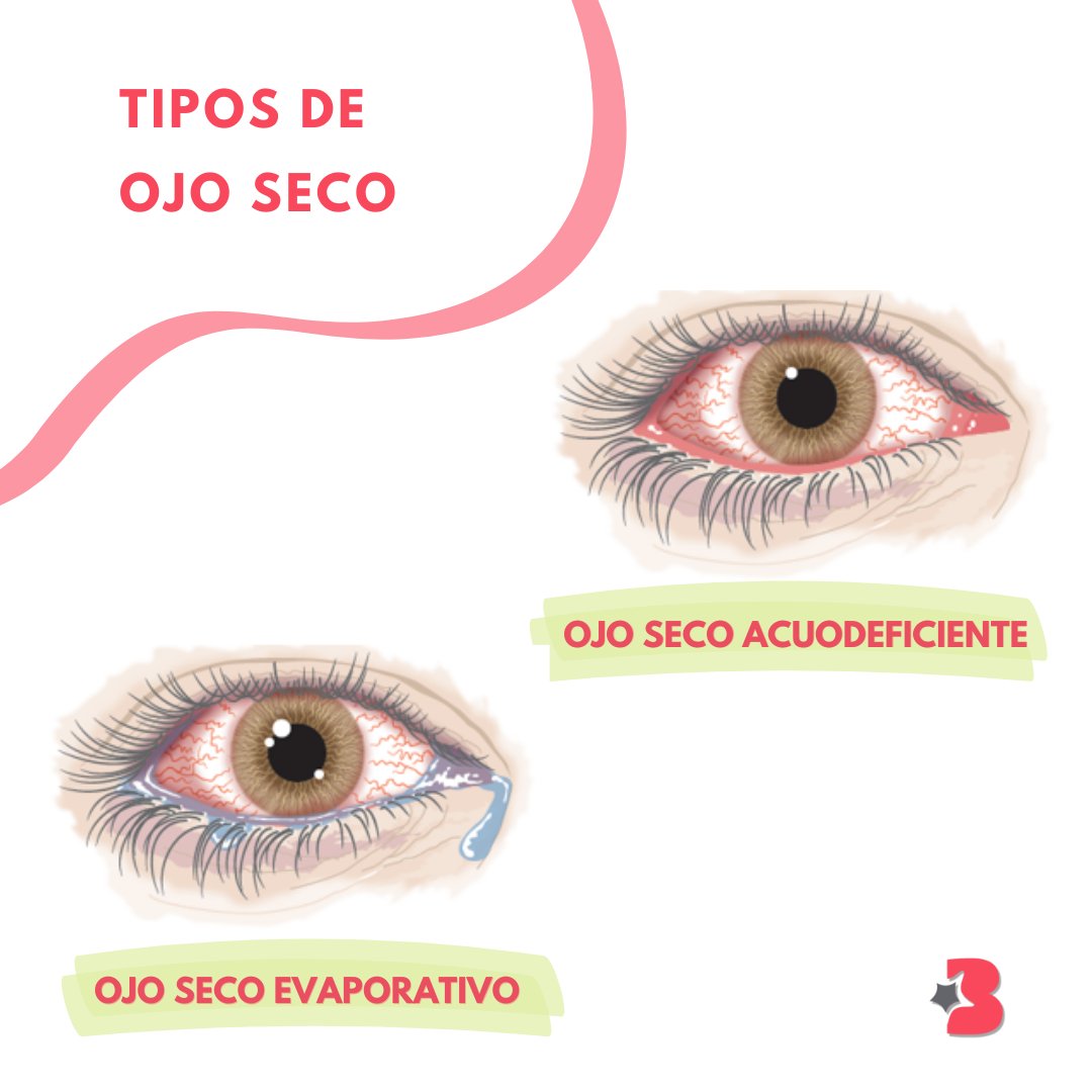 tipos de ojo seco