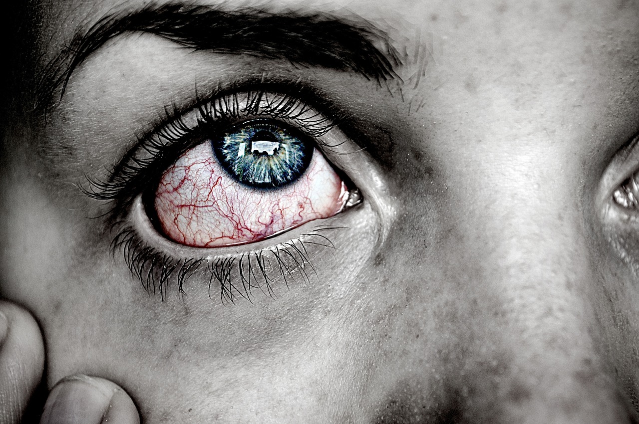 Cómo afectan la suciedad y la alergia a los ojos